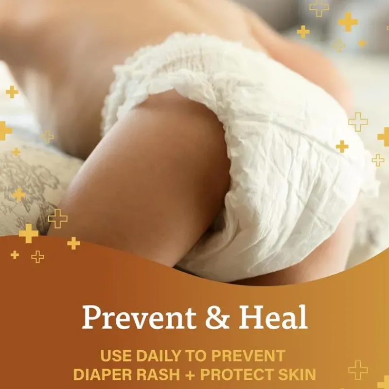 ad__original_diaper_rash__SKUU0eR7hjh_4.webp MacroBaby A+D - Original Diaper Rash Ointment 16Oz Outlet